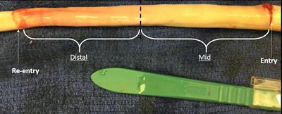 Validated Computational Model to Compute Re-apposition Pressures for Treating Type-B Aortic Dissections